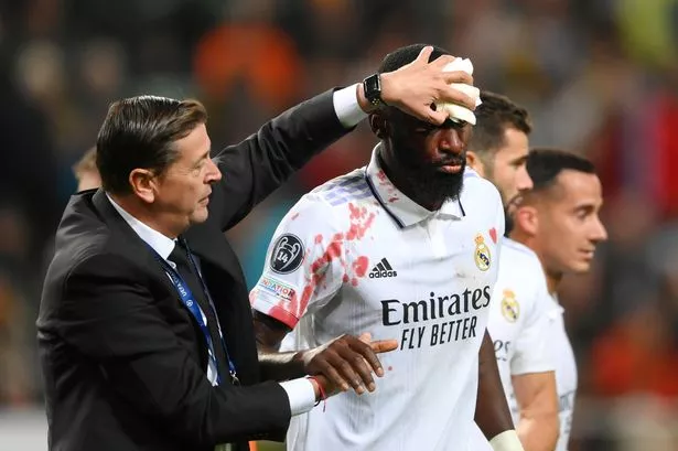 Rudiger Injured Again: A Look at His Injury History.