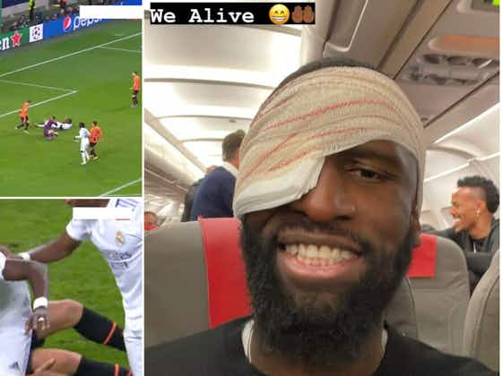Rudiger Injured Again: A Look at His Injury History.