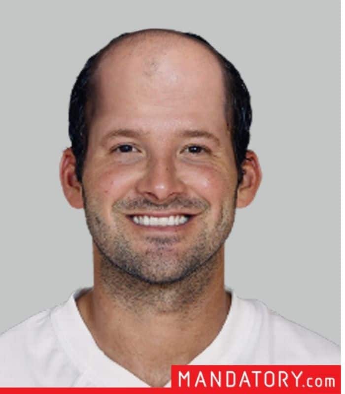Tony Romo Hairpiece: Did the Former Quarterback Get a Hair Transplant?