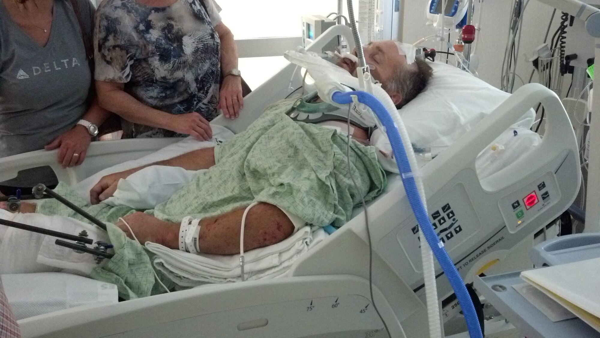 Bike Accident Hospital Visit? The Complete patient Guide.