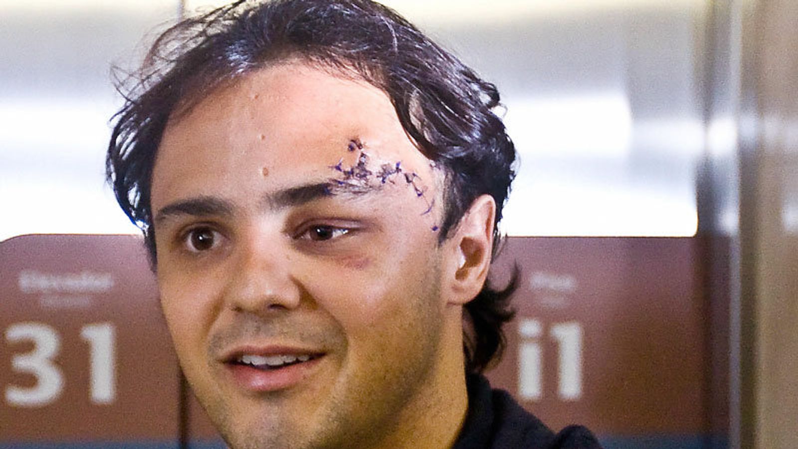 Felipe Head Injury Updates: (Latest News & Reports)