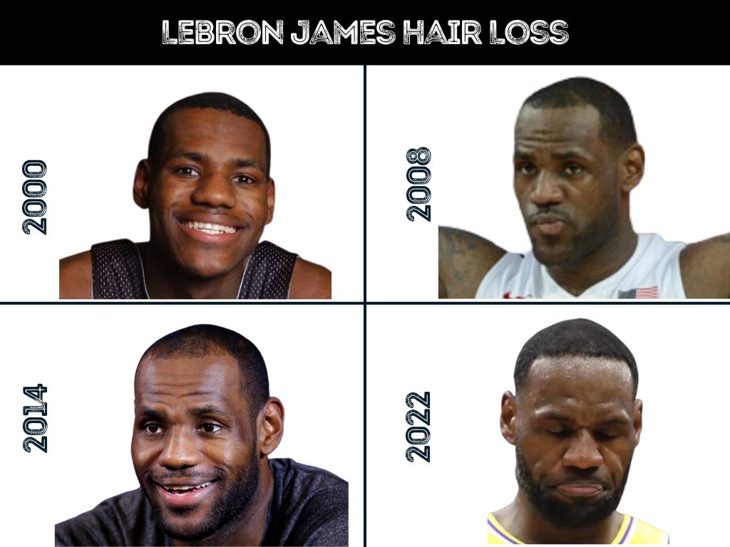 Why do people talk about lebron fake hair? Understanding the fascination with celebrity appearances and changes.