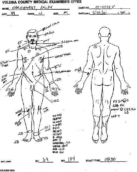 Dale Earnhardt Sr Autopsy: Details You Need to Know.