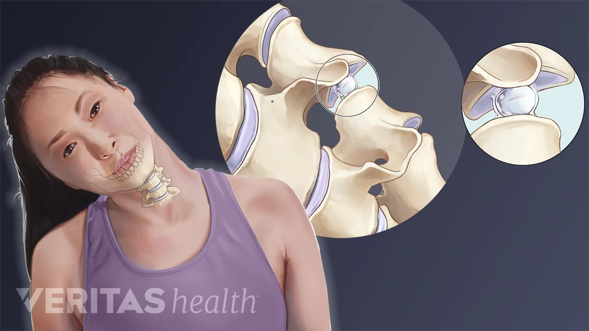 Why does my neck crunch when I roll my head? Discover when you should actually talk to a doctor about it.