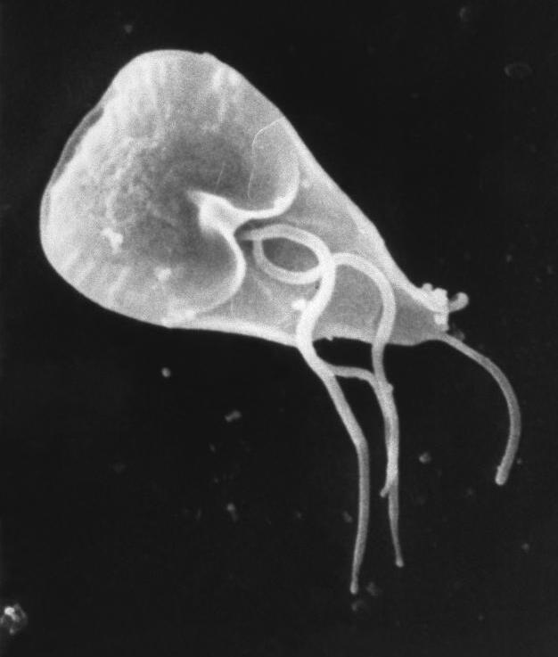What does a real giardia image look like? See clear pictures to help identify this intestinal parasite now.